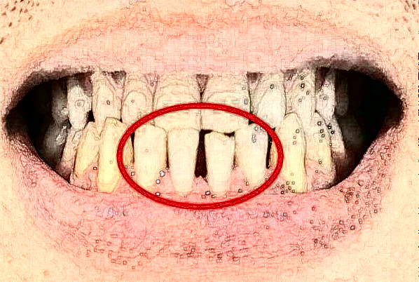 天津醫(yī)科大學(xué)第二醫(yī)院口腔科正畸怎么樣_哪個(gè)醫(yī)生比較好