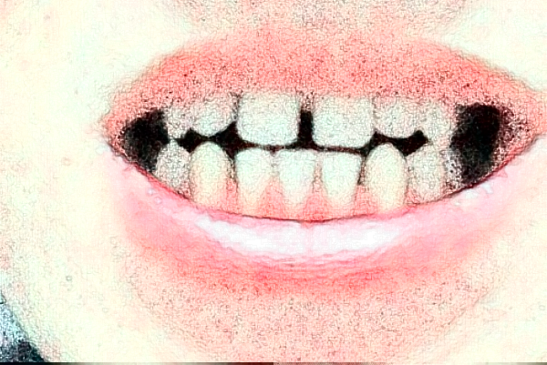 2024揚州市第一人民醫(yī)院整牙醫(yī)生排名_口碑+價格