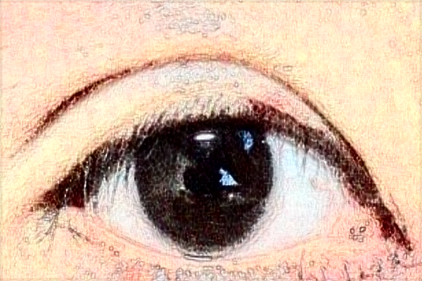 天津市第三中心醫(yī)院全飛秒做的怎么樣,哪位醫(yī)生技術(shù)比較好