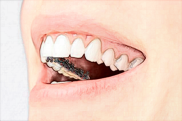 蘭州大學(xué)第二醫(yī)院整形科醫(yī)生好嗎?割雙眼皮哪個(gè)醫(yī)生好