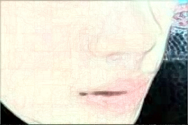 2024無錫市第一人民醫(yī)院光子嫩膚怎么樣_整形日記分享