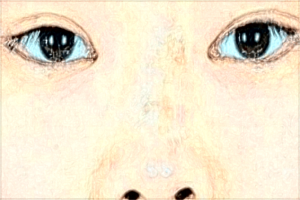 2024佛山市禪城區(qū)中心醫(yī)院熱瑪吉價格?熱瑪吉是什么