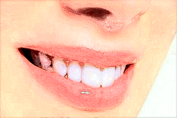 佛山市禪城區(qū)中心醫(yī)院口腔科怎么樣?口腔科收費(fèi)價(jià)目表