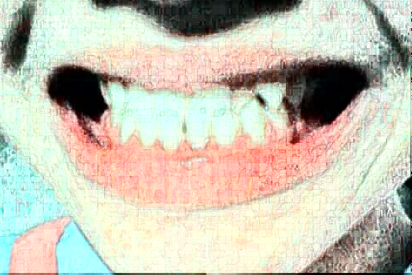 大連大學(xué)附屬中山醫(yī)院口腔科錯牙合畸形矯正做的好嗎?醫(yī)生推薦