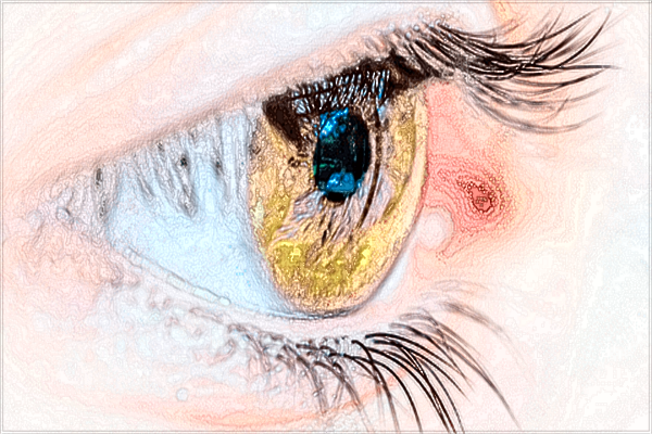 2024煙臺(tái)毓璜頂醫(yī)院近視眼激光手術(shù)價(jià)格?近視眼激光手術(shù)的風(fēng)險(xiǎn)