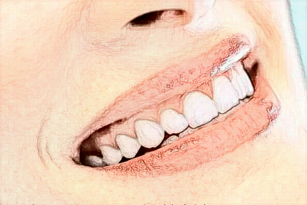 珠海市人民醫(yī)院正畸醫(yī)生怎么樣?2024正畸收費貴嗎