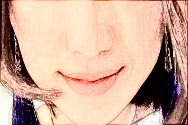 南京中大醫(yī)院光子嫩膚價目表(價格表)口碑怎么樣