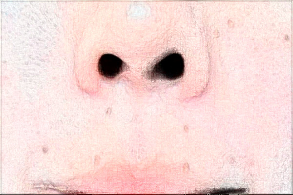 無錫市第一人民醫(yī)院激光脫毛做的怎么樣_誰做的比較好