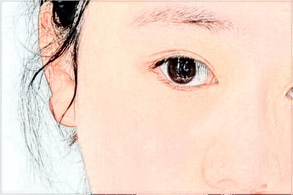 2024揚州市第一人民醫(yī)院去眼袋價格是多少?那個醫(yī)生好