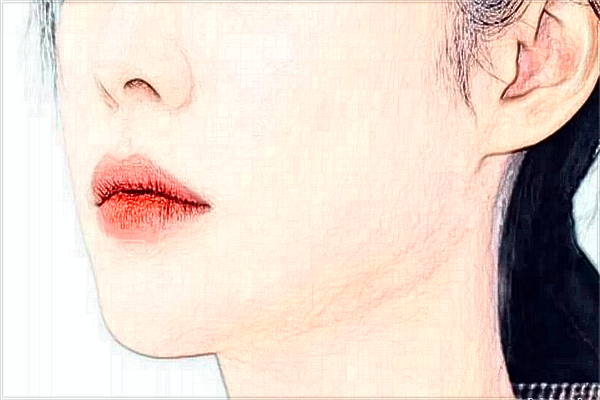 河北省人民醫(yī)院祛疤做的好嗎?真實(shí)案例反饋