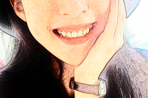 天津市第三中心醫(yī)院口腔科根管做的好嗎？根管整形日記