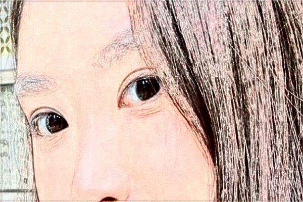 2024吉林大學(xué)第一醫(yī)院全飛秒做的好嗎?誰做得好