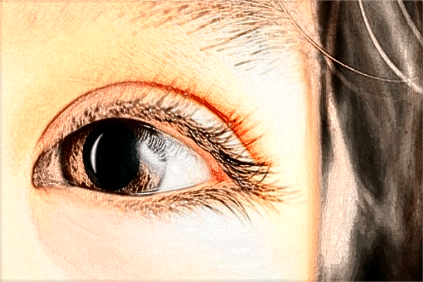 2024佛山市第二人民醫(yī)院去眼袋手術(shù)費(fèi)用?去眼袋恢復(fù)期多久