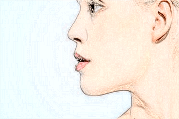 2024煙臺(tái)毓璜頂醫(yī)院光子嫩膚多少錢(qián)?光子嫩膚祛斑怎么樣