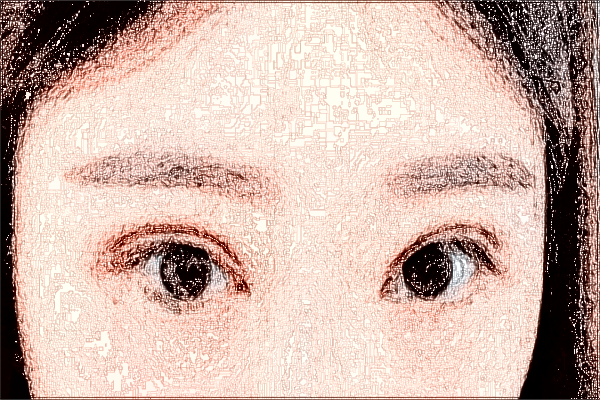 常德市第一人民醫(yī)院近視手術(shù)怎么樣?2024飛秒手術(shù)價(jià)格貴嗎