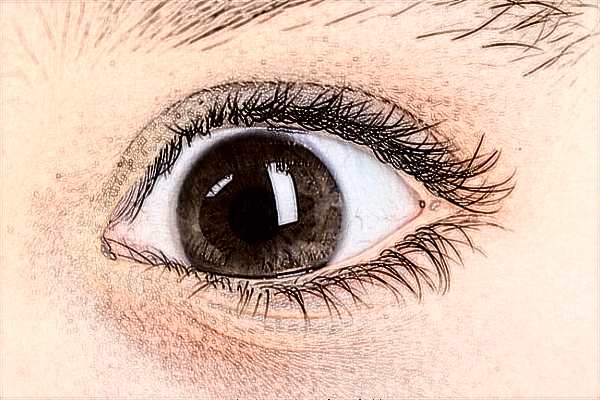 2024常德市第一人民醫(yī)院近視手術(shù)價格?近視手術(shù)多少度能做