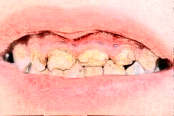 無錫市第一人民醫(yī)院口腔科鑲牙怎么樣_醫(yī)生名單推薦