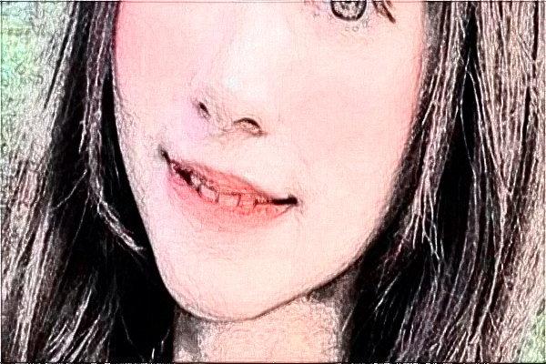 南通大學(xué)附屬醫(yī)院去胎記怎么樣_體驗(yàn)日記分享