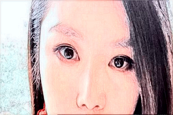 天津醫(yī)科大學總醫(yī)院熱瑪吉需要多少錢?醫(yī)生推薦