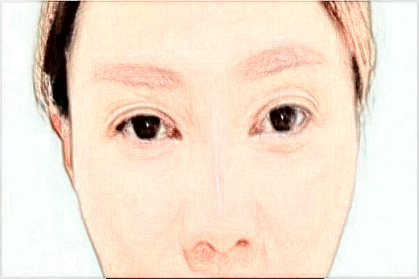 綿陽(yáng)市中心醫(yī)院激光美容怎么樣_真實(shí)案例反饋