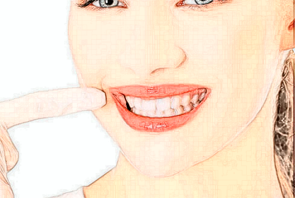 延邊醫(yī)院正畸做的好不好?醫(yī)生排名