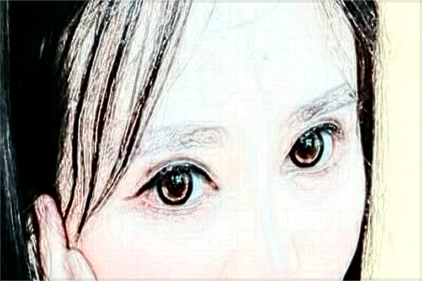 2024江蘇省人民醫(yī)院半飛秒好不好?體驗(yàn)日記反饋