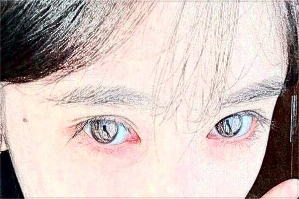 2024無(wú)錫市第一人民醫(yī)院激光去紋眉做的可以嗎？