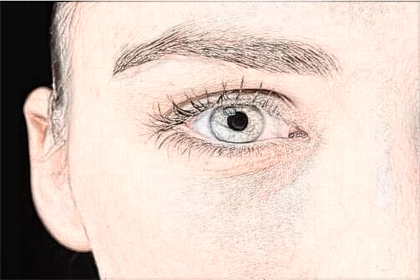 青島市立醫(yī)院激光科屬于什么科?2024激光科收費(fèi)價格