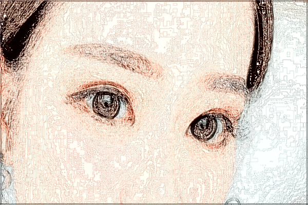 2024佛山市第二人民醫(yī)院去眼袋怎么樣?去眼袋手術(shù)恢復(fù)期