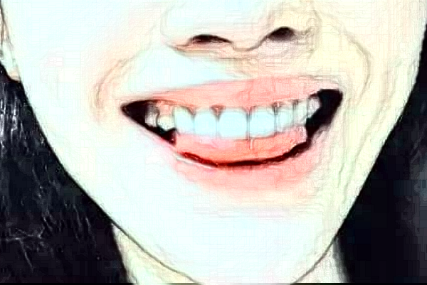 2024安徽省立醫(yī)院牙齒正畸怎么樣_誰(shuí)做得好