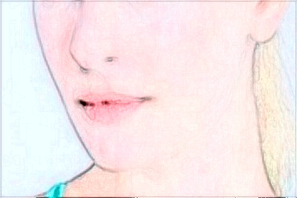 2024上海東方醫(yī)院隆鼻怎么樣_哪位醫(yī)生比較好