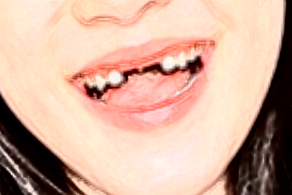 丹東市第一醫(yī)院鑲牙技術(shù)好嗎?哪位醫(yī)生做得好