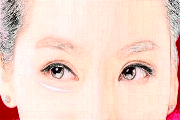 蘇北人民醫(yī)院半飛秒做的好嗎?誰(shuí)做得好