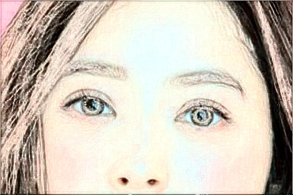 蘇北人民醫(yī)院半飛秒做的好嗎?誰(shuí)做得好