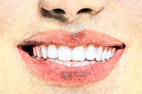 大慶市人民醫(yī)院口腔科隱形矯正價(jià)格多少?做的怎么樣