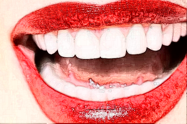 鎮(zhèn)江江濱醫(yī)院種植牙怎么樣?哪個醫(yī)生做的比較好