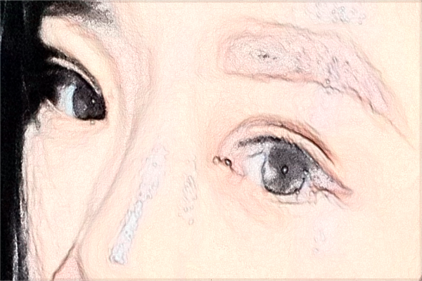 2024?？谑腥嗣襻t(yī)院近視激光手術(shù)費(fèi)用?近視手術(shù)需要多久