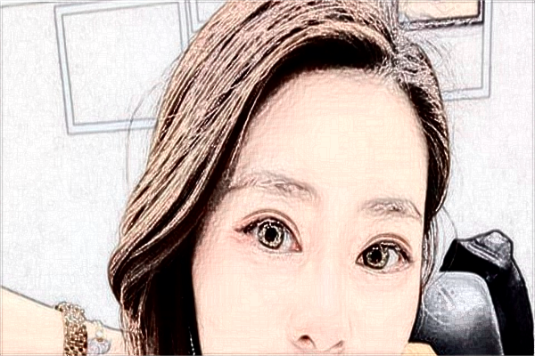 ?？谑腥嗣襻t(yī)院醫(yī)美怎么樣?醫(yī)美項目都有哪些