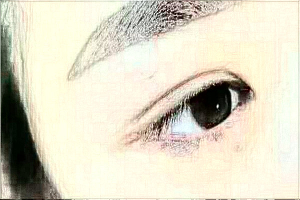 2024延邊醫(yī)院去除眼袋案例反饋，做過的都說不錯