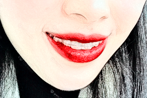 2024蘇州康美美容醫(yī)院鑲牙怎么樣_誰做得好