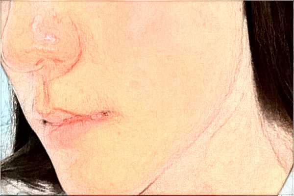 2024杭州市第一人民醫(yī)院熱瑪吉怎么樣_誰(shuí)做得好