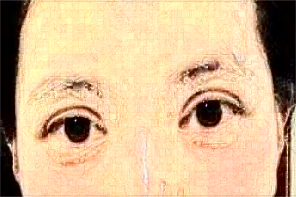 2024徐州醫(yī)科大學(xué)附屬醫(yī)院割雙眼皮多少錢_醫(yī)生名單推薦