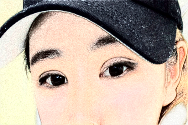 2024徐州醫(yī)科大學(xué)附屬醫(yī)院祛疤價(jià)格需要多少_真實(shí)案例分享