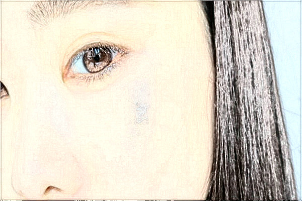 南京鼓樓醫(yī)院去胎記做的好嗎？誰做的好