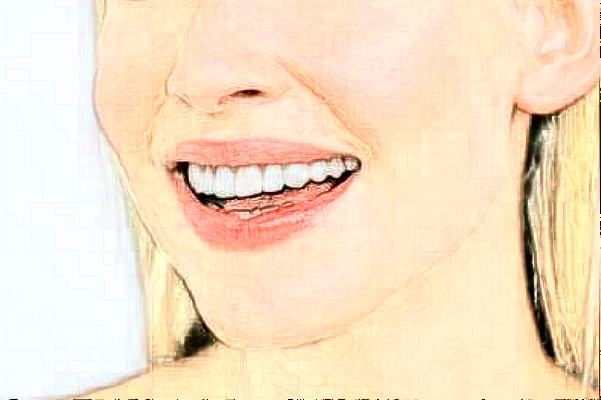 2024齊齊哈爾市中醫(yī)院根管怎么樣_誰做得好