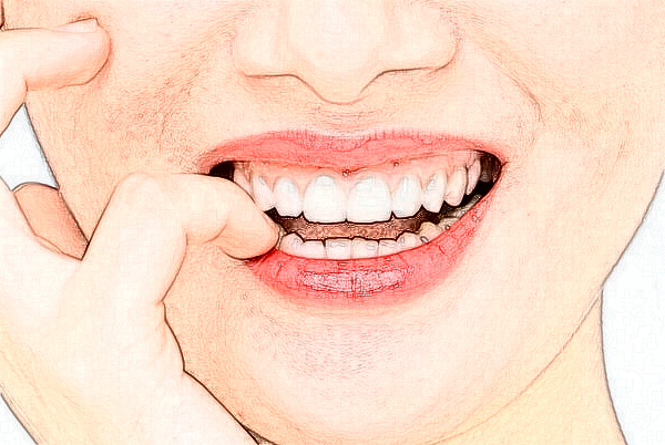 徐州醫(yī)科大學附屬醫(yī)院成人正畸做的好嗎?哪位醫(yī)生做得好