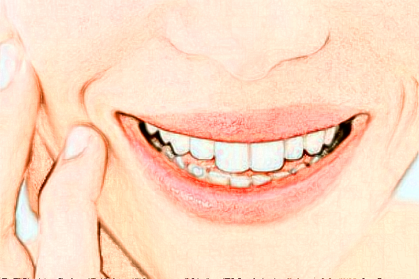 2024青島市立醫(yī)院隱適美價(jià)格?隱適美矯正牙齒利弊