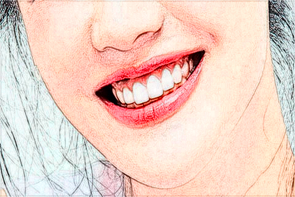 2024懷化市第一人民醫(yī)院拔智齒多少錢?拔智齒注意事項(xiàng)