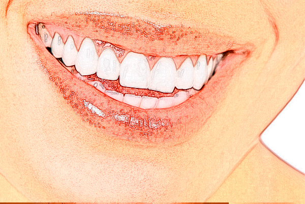 2024懷化市第一人民醫(yī)院補蛀牙價格?哪個醫(yī)生補蛀牙水平好