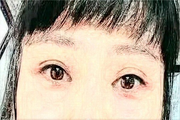 2024株洲市中心醫(yī)院雙眼皮手術(shù)收費(fèi)價(jià)格?割雙眼皮好嗎